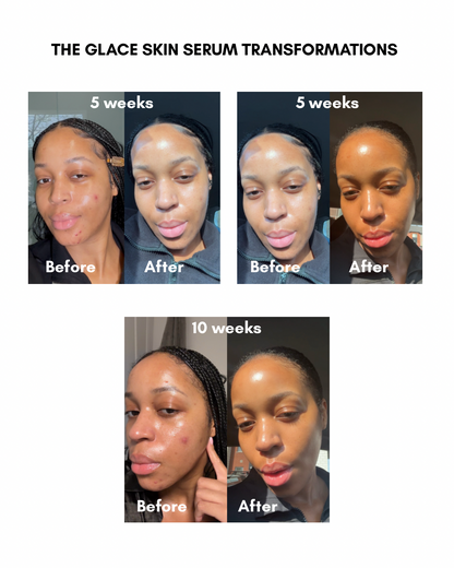Glace Skin Serum