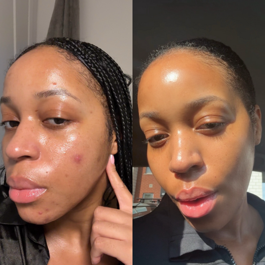 Glace Skin Serum